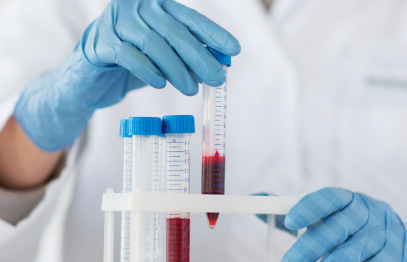 Stradiņa slimnīcas Apvienotā laboratorija maina paraugu ņemšanas kabineta darba laiku.