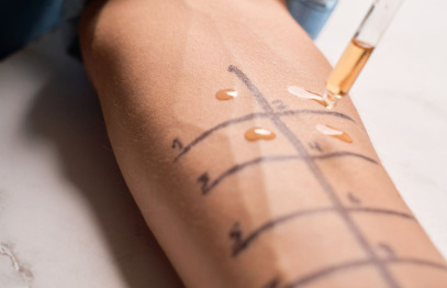 Atpazīt laikus, rīkoties droši: Stradiņa slimnīca aicina apmeklēt Alerģijas dienu